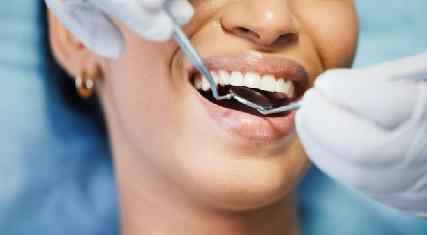 Best Dental Abscess Treatment in Lyndon, KS